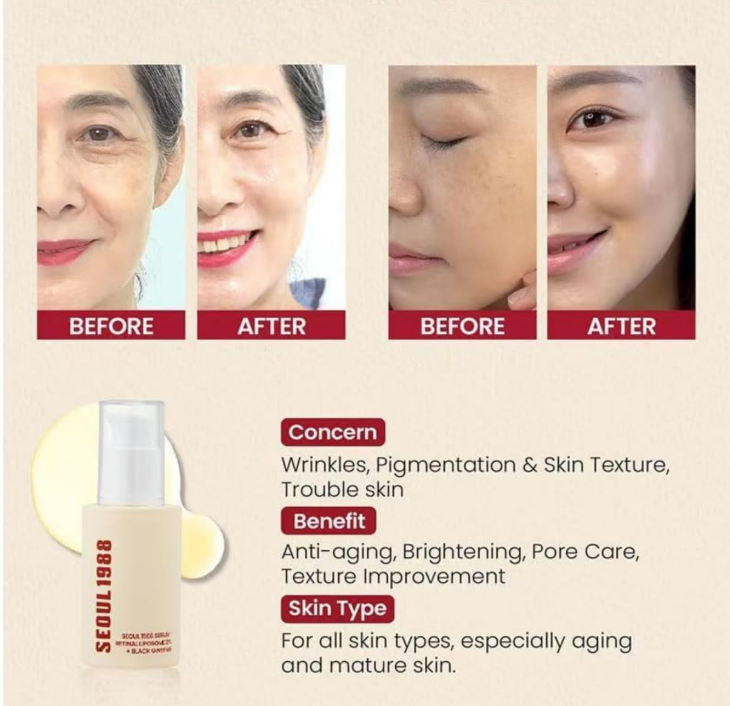 SEOUL 1988 Retinal Serum – Formulated with Advanced Retinal Liposome 2% and 58% Black Ginseng Extract | Fine Lines and Skin Texture Care Serum | Korean Skincare, 30ml / 1.01 fl oz